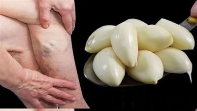 THIS ANCIENT REMEDY FROM THE PAST SOLVES A COMMON PROBLEM AMONG WOMEN