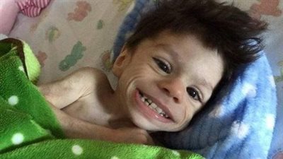 “A Story With a Happy Ending”: How the Boy Who No One Wanted to Adopt Lives Now