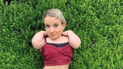 25 inch dancer scolded for having an affair with a 19-year-old boy twice her height