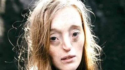 Young girl was born with rare facial defect – now she’s breaking beauty standards with her modelling career