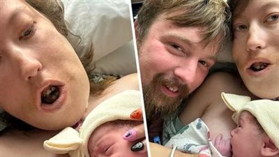 People Said I Don’t Deserve to Be a Mom Due to My Disability, but I Gave Birth to “Ideal” Baby (Photos)