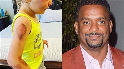 ‘Fresh Prince’ star Alfonso Ribeiro shares devastating photo of his daughter 1 day before her fourth birthday