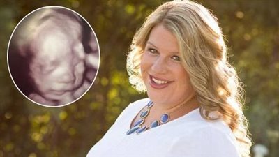 After her husband dies, she finds out she’s pregnant – then she sees the jaw-dropping ultrasound