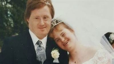 Couple with Down syndrome proved all doubters wrong: Lived happily for 25 years before tragedy struck