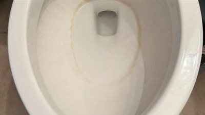 How To Remove Hard Water Stains From A Toilet Bowl