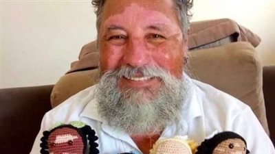 “Empowering Sick Children”: 64-Year-Old Man Knits Vitiligo Dolls to Boost Confidence