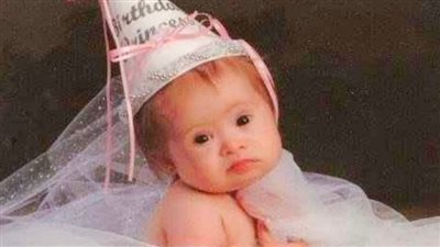 Doctors wanted to put girl with Down syndrome in an institution – 15 years later, she’s a top model