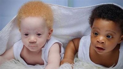 Mother gives birth to black and white twin boys – but neither parent is white