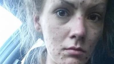 Overcoming Addiction: Jamee’s Journey to Recovery