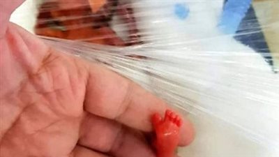She weighed less than a pound at birth and doctors thought she would not survive
