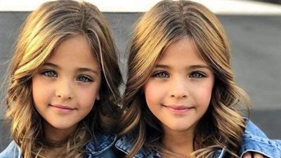 12 Years Ago They Were Called The World’s Most Beautiful Twins – Now Look At Them