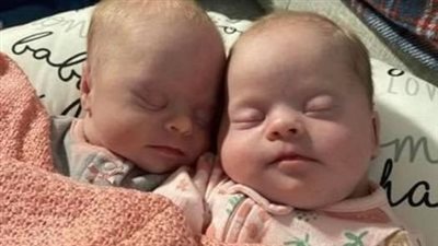 Mom of rare twins with Down syndrome show how beautiful and precious they are to shut down critics