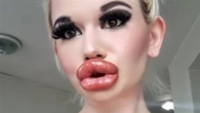 Pursuing the Dream of the Biggest Lips: Andrea Ivanova’s Extraordinary Journey