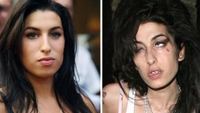 Amy Winehouse: The Before and After of Drugs and Alcohol